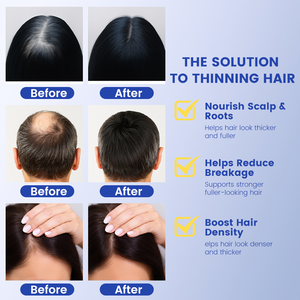 Sérum capillaire GHK-Cu AHK-Cu, prévention de la chute des cheveux, nutrition du cuir chevelu, réduit la chute, améliore l'élasticité des cheveux, sérum ahk-cu - Product Image 4