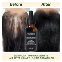 Huile Essentielle Nourrissante pour la Croissance des Cheveux, Sérum Capillaire Rafraîchissant et Réparateur à l'Acide Salicylique pour Lisser les Cheveux, Huile de Gingembre