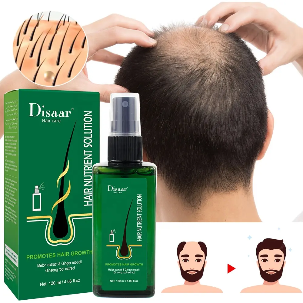 Anti Hair Loss Treatment natural ginger root & melon fast hair growth serum hair growth oil serum for men and women