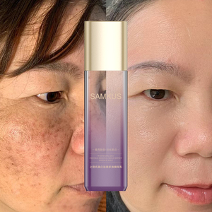 Lait d'essence multi-effets éclaircissant et anti-taches OEM/ODM pour le <span class=keywords><strong>soin</strong></span> du <span class=keywords><strong>visage</strong></span> féminin, éclaircissant et anti-imperfections - Product Image 4