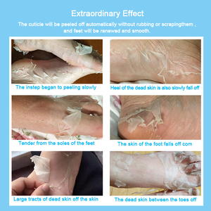 ผลิตภัณฑ์ที่ดีที่สุดในการขายเกาหลีดูแลหน้ากากเท้าลบหนังกำพร้าที่ตายแล้วลอกเท้าหน้ากาก - Product Image 2