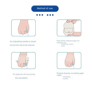 Transparent Breathable Material <strong>Disposable</strong> Film Chg <strong>I.v</strong>. Dressing Wound Fixation <strong>Cannula</strong> Clear Fixed Dressing With Notch - Product Image 5