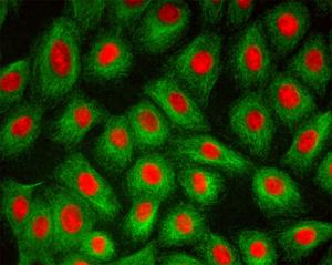 BestScope BS-2063FT(LED、TB) Trinocular LED蛍光生物顕微鏡 (<span class=keywords><strong>Tuberculosis</strong></span> Test用) - Product Image 5