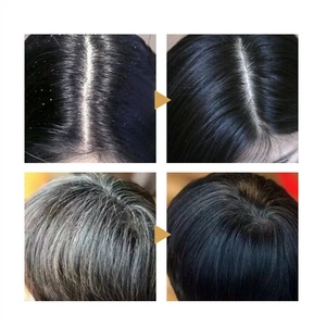 Soap Cover Bar Shampoo Deep Cleansing Hair and <strong>Scalp</strong> Natural Organic <strong>Moisturises</strong> and Repairs Promotes Hair Growth BLACK SOAP - Product Image 4