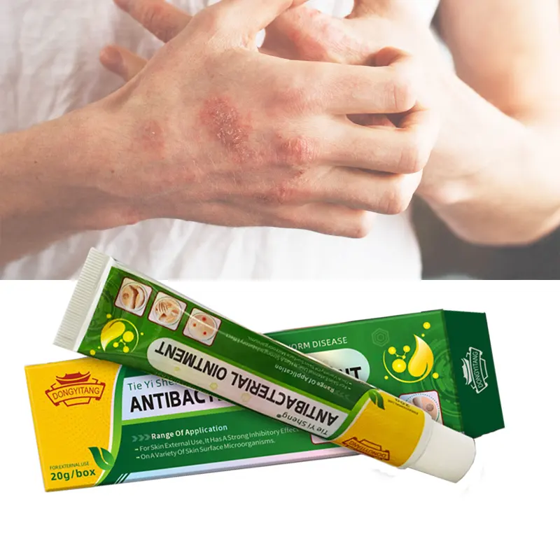 Grosir krim eksim salep Pengobatan gatal Psoriasis kulit