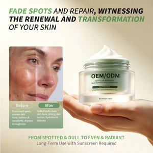 Crema Correctora de Manchas con Niacinamida y Centella Asiática de Marca Privada - Crema Facial Vegana Iluminadora, Reparadora y Antienvejecimiento 2% - Product Image 3