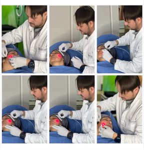 Medische Vezel Laser 980nm + 1470nm Lipolyse Gezicht Huid Lifting Lichaam Vormgeven Vetverwijdering Plastic Lasermachine - Product Image 4