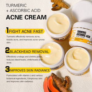 Crema Facial Antiacné Ailke Herbal con Cúrcuma y Vitamina C para Aumentar el Brillo, Combatir las Manchas <span class=keywords><strong>de</strong></span> Acné, Exfoliar y Reparar la Piel - Product Image 3