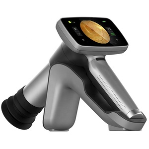Precio <span class=keywords><strong>barato</strong></span> HFC 2 Cámara de fondo de Oftalmología Cámara de retina digital portátil para la venta - Product Image 1