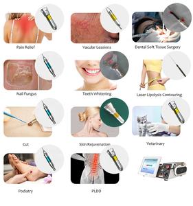 Dispositivo de terapia láser de diodo de 980 y 1470nm estándar de la UE y EE. UU. Para lipólisis/corte/fisioterapia/ginecología/hongos <span class=keywords><strong>en</strong></span> las uñas/PLDD/EVLT - Product Image 2