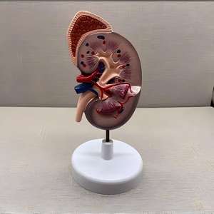 Modelo de Riñón con Glándula Adrenal - Herramienta Educativa de <span class=keywords><strong>Nefrología</strong></span> - Product Image 5