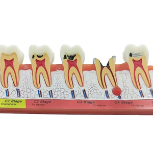 गाजर चित्रण विकास दंत दांत मॉडल - Product Image 1