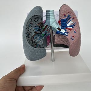 Modelo de Comparación de Ciencias Médicas: Pulmones Humanos Fumadores, Patología, Modelo de Enfermedad, Modelo de Enfermedad Orgánica, Modelo Antidrogas - Product Image 2