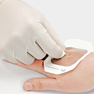Hongsheng Medical PU Transparent <b>Dressing</b> Film for PICC Indwelling Catheter Fixation, <b>Waterproof</b> <b>Dressing</b> for Wounds, 6*7cm - Product Image 2