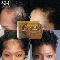 Vente chaude naturel bio shampooing barre savon la croissance des cheveux riz eau shampooing barre pour cheveux savon couverture barre shampooing