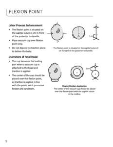 Système d'aspiration complet OmniCup Kiwi pour gynécologues, pour usage hospitalier Kiwi 0mni 5015G - Product Image 4