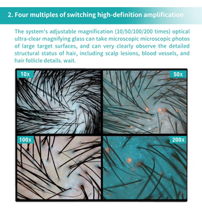 Ai trichoscope Máy tính để bàn tóc da đầu phân tích Máy phát hiện nang trứng dẫn nguồn ánh sáng để phân tích khuôn mặt hỗ trợ EU JP chúng tôi cắm - Product Image 4