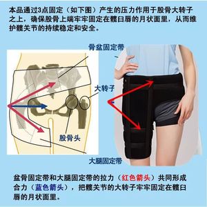 Férula ortopédica para fijación de la articulación de la cadera, férula para fijación ósea de la cadera, rehabilitación ortopédica femoral y de muslo - Product Image 5