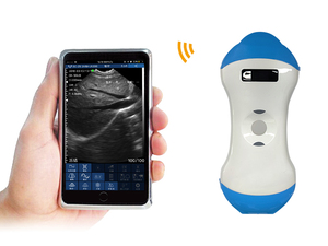 5mn Dubbele Kop Draadloze Echografie Cardiale Draagbare <span class=keywords><strong>Doppler</strong></span> Gefaseerde En Lineaire Scanner Echocardiografie Ce - Product Image 5