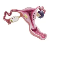 Artificial Female Uterus Organ Anatomical Model