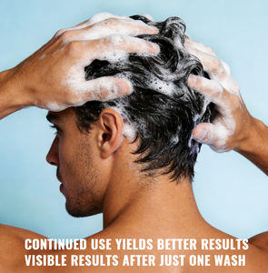 Shampooing Quotidien Purifiant et Rafraîchissant à l'Extrait Végétal et aux Herbes, Contrôle du Sébum, Anti-Pelliculaire pour Hommes - Product Image 4