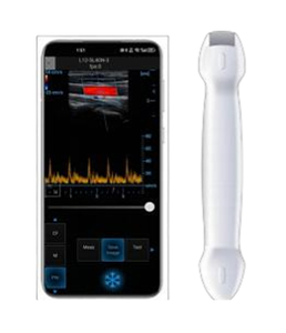 उच्च गुणवत्ता वाले पोर्टेबल अल्ट्रासाउंड डिजिटल वायरलेस हैंडहेल्ड अल्ट्रासाउंड मशीन डॉक्टर के उपयोग के लिए - Product Image 2