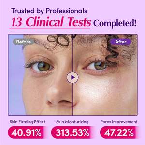 Esencia de Vitamina C OEM/ODM para Aclarar la Piel con Nicotinamida 30ml Fortalece la Barrera Cutánea e Hidrata para el Cuidado de la Piel Femenina - Product Image 2