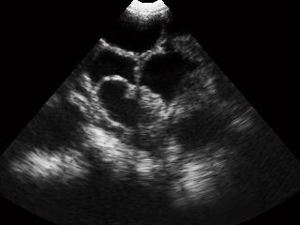 Vétérinaire <span class=keywords><strong>Usg</strong></span> Midray <span class=keywords><strong>Usg</strong></span> Machine pour le diagnostic abdominal <span class=keywords><strong>Usg</strong></span> - Product Image 6