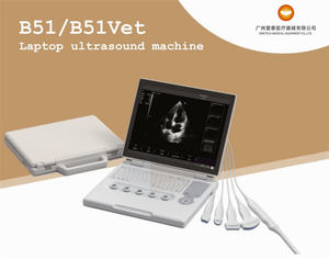 128 yếu tố probe 15 "8-12 giờ pin xách tay B/W xách tay với siêu âm DOPPLER màu của xung chức năng sóng máy siêu âm hệ thống - Product Image 3