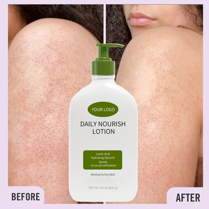 <span class=keywords><strong>Lotion</strong></span> corporelle nourrissante quotidienne personnalisée, 12% d'acide lactique, <span class=keywords><strong>lotion</strong></span> <span class=keywords><strong>exfoliante</strong></span> et hydratante pour peaux sèches - Product Image 2