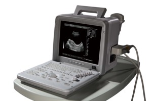 Mesin ultrasound laptop portabel & Murah hitam putih pemindai ultrasound mesin pemindai ultrasound resolusi tinggi - Product Image 5