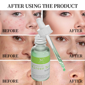 Ngậm nước khỏe mạnh tìm kiếm da nước dầu cân bằng axit amin giữ ẩm chống lão hóa lột soloution Mặt huyết thanh 30ml - Product Image 3