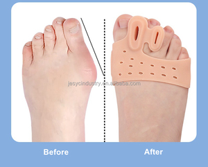 Coussinet métatarsien <span class=keywords><strong>pour</strong></span> soins des pieds, semelle intérieure en gel <span class=keywords><strong>pour</strong></span> soulagement de la douleur, correcteur de <span class=keywords><strong>hallux</strong></span> <span class=keywords><strong>valgus</strong></span>, correcteur d'arthrose, séparateur d'orteils - Product Image 3