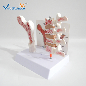 Modelo de Hueso de Osteoporosis, Modelo Anatómico de Esqueleto Humano en PVC para Escuelas - Vic <span class=keywords><strong>Science</strong></span> VIC-V45 - Product Image 6