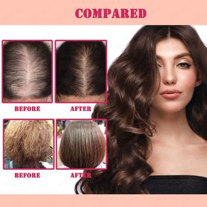 Aceite para el Crecimiento del Cabello de Fresa y Menta, Hidratante Profundo y Fortalecedor, Sin Silicona, Sin Crueldad, Aceites para el Tratamiento del Cabello de Marca Privada - Product Image 4