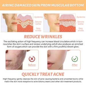 High Frequency Acene Treatment Facial Therapy Wand Portable Face Skin Care Beauty Equipment Products for Women - Product Image 5