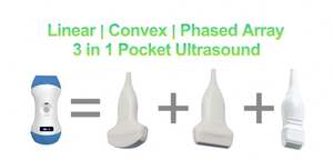 SY-AC51_CPL pemindai <span class=keywords><strong>ultrasound</strong></span> nirkabel, pemindai <span class=keywords><strong>ultrasound</strong></span> saku cembung/linear/phased array 3 dalam 1 - Product Image 2