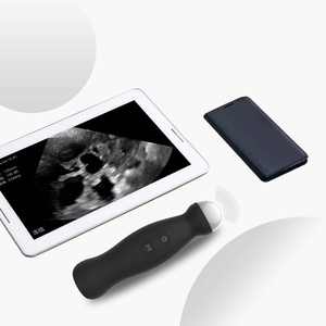Dawei Sonde à ultrasons mécanique sans fil Scanner vétérinaire B à ultrasons pour cochon - Product Image 4