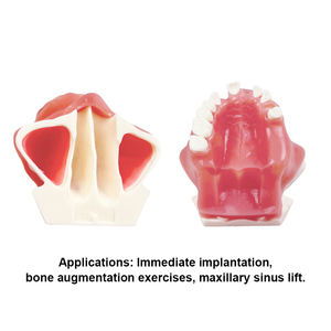 Hoogwaardig tandmodel voor onmiddellijke implantatopraktijk, geschikt voor demonstraties bij tandartsen en studententraining - Product Image 6