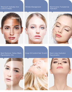 Appareil de mésothérapie haute pression 2026 en ABS pour rajeunissement cutané non invasif, lifting facial et soin du cuir chevelu - Product Image 5