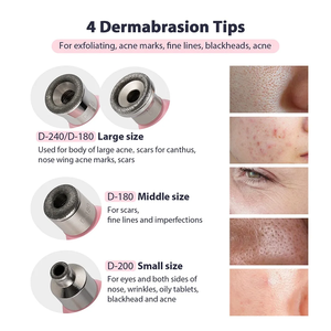 Mini Máquina de Microdermoabrasión con Punta de Diamante para Eliminar Puntos Negros, Acné y Comedones, Versión Portátil, para Salón de Belleza y Cuidado de la Piel - Product Image 3