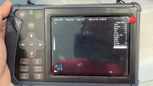 DM Krankenhaus Tragbares Ultraschallgerät zum Fabrikpreis Handgeführtes Veterinär-Ultraschallgerät Tragbarer Ultraschallscanner für Tiere - Product Image 4