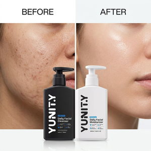 Set di Prodotti per la Cura della Pelle Maschile a Marchio Privato, Naturale, Detergente, <span class=keywords><strong>Idratante</strong></span>, Anti-Acne e Anti-Crespo - Product Image 3