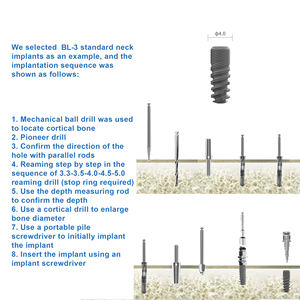 Implante Dental CANWELL BL-3 Clase III con Garantía de por Vida, Fabricantes de Implantes Dentales, Superficie S.L.A, Kit Quirúrgico de Titanio Puro, Pilar de Implante - Product Image 3