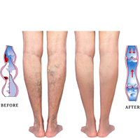 Meilleures ventes : Chaussettes de sport à compression mi-hautes pour hommes, antidérapantes, avec fermeture éclair, pour le cyclisme, la course à pied, la gym, les activités sportives quotidiennes en extérieur