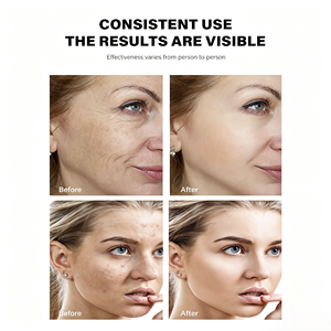 Crème visage au rétinol ZLZR AHA BHA anti-âge, réduit les ridules, raffermit, hydrate et revitalise la peau, pour femmes - Product Image 2