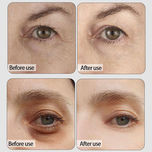 Bosman OEM Caviar Eye Mask Antienvejecimiento Colágeno Eye Patch Black Gold Pearl Caviar <span class=keywords><strong>Hidrogel</strong></span> Collagen Eye Gel Mask - Product Image 4