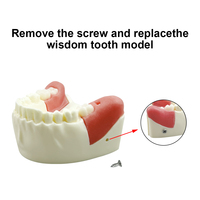 Modelo de Práctica para Extracción de Dientes Impactados, Modelo Oral Simulado con Diente Impactado Removible y Base Desmontable