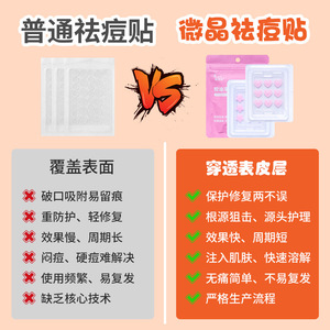 Parches para el Acné Bck en Forma de Estrella, Color Rosa, Control de Grasa, Cuidado de la Piel Transparente para Piel Grasa y Mixta - Product Image 2