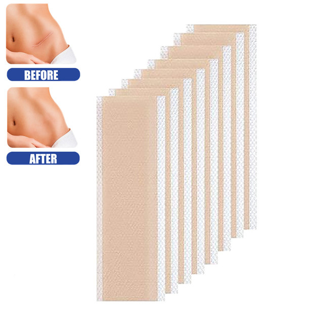 Skin Waterproof Silicone Scar Patch Remove Sheet Silicone Gel Scar Tape Scar Removal Sheet